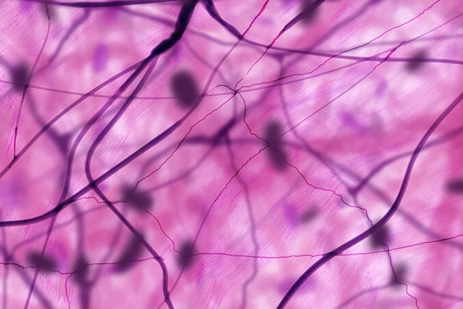 tessuto-connettivo-cos’è Tessuto connettivo